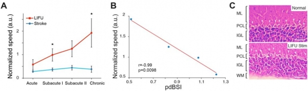 운동신경 회복과 델타파의 상관 관계 및 안정성 검증