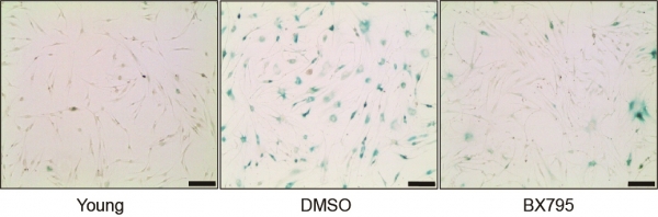 사진 왼쪽부터 젊은 세포와 노화된 세포, 역 노화 원천기술이 적용된 세포.