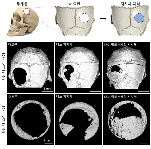 나노 멀티스케일 지지체의 뼈 조직 재생 효능 평가