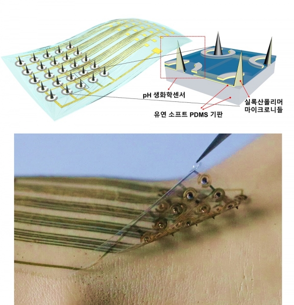 그림 1. 연구에서 개발한 플렉서블 마이크로니들 생화학센서의 개요도 및 실제 사진