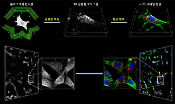 개발된 인공지능 현미경 개요 및 예시