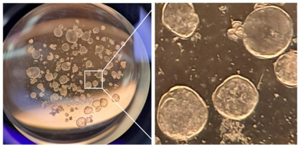 폐 오가노이드 현미경 확대 사진 / KIT 제공