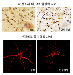 정상 및 헌팅턴병 환자의 뇌조직 내 FAK 활성화 정도 및 신경세포 돌기형성 차이