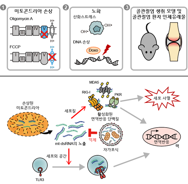 골관절염의 발병 메커니즘 모식도