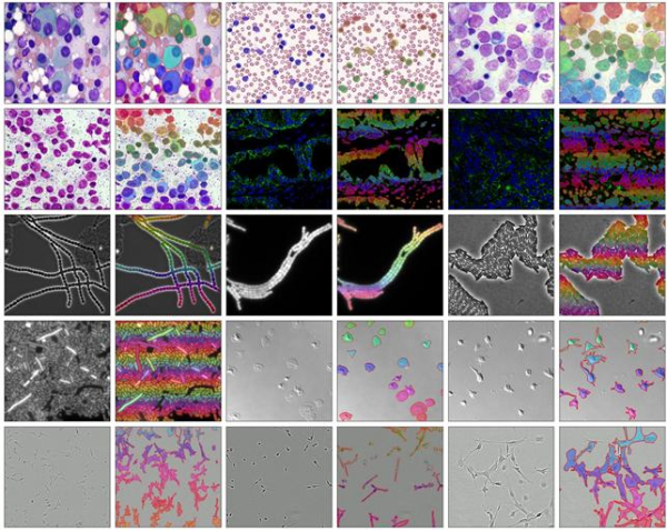 다양한 상황에서 관찰된 현미경 이미지에서 MEDIAR 인공지능이 세포를 인식한 결과를 시각화한 모습.