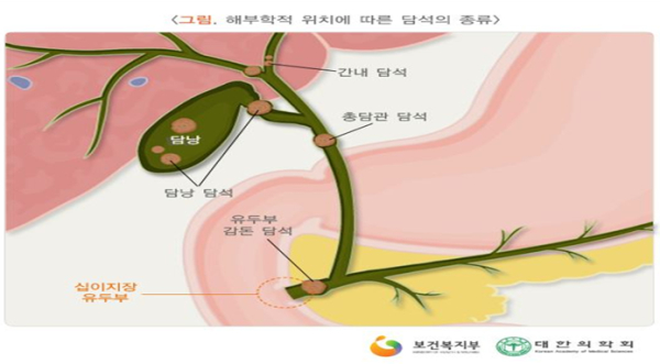 ( 출처 : 국가건강정보포털 건강칼럼 )