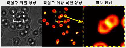 적혈구 복원 영상