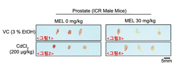 마우스의 카드뮴 노출에 따른 전립선 조직의 변화