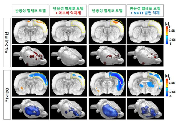반응성 별세포 동물 모델에서 PET 영상 촬영을 통해 관찰되는 11C-아세트산 흡수 증가와 18F-FDG 흡수 감소.jpg