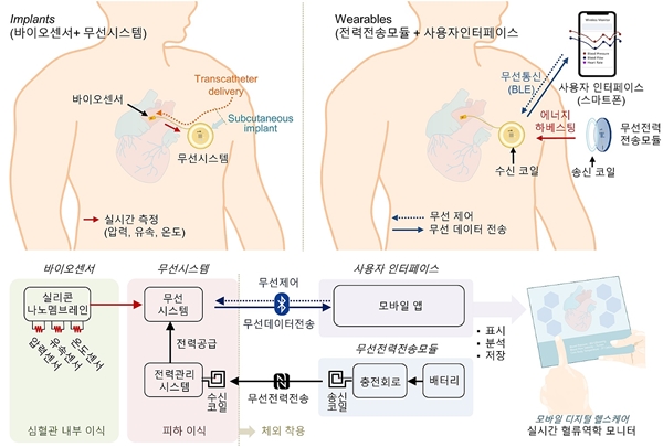 무선 심혈관 모니터 기술 모식도