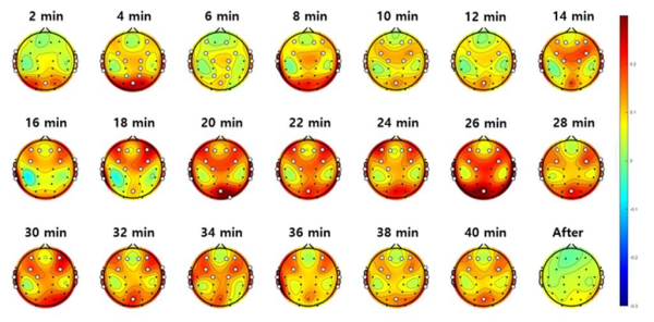 tVNS 인가 전 대비 인가하는 동안 및 인가가 끝난 후(After)를 비교한 그림으로 20분부터 tVNS로 인한 뇌활성화가 가장 강하게 나타났음을 확인한 자료