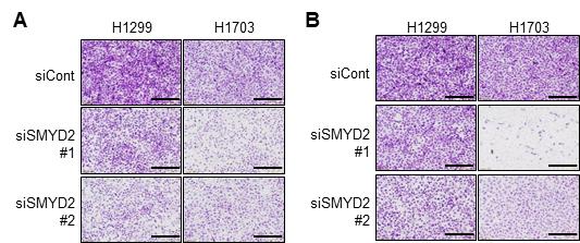 SMYD2 단백질에 의한 폐암 이동 및 침윤 억제 확인(세포실험)