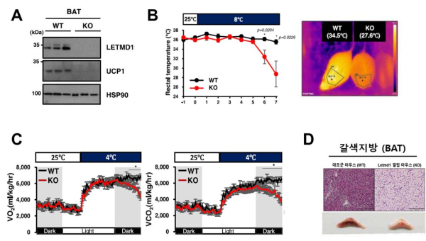 LETMD1의 갈색지방 열 생성 제어기전