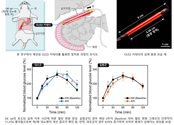 OLED 카테터를 활용한 빛 치료 과정의 모식도와 디바이스