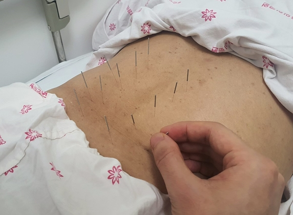요통 침치료 모습