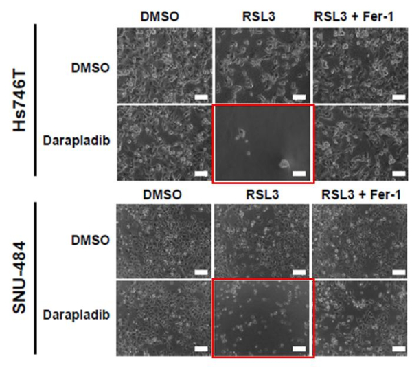 페로토시스 유도제(RSL3)와 다라플라딥(포스포라이페이스 A2)를 함께 사용했을 때의 위암 세포사멸 효과
