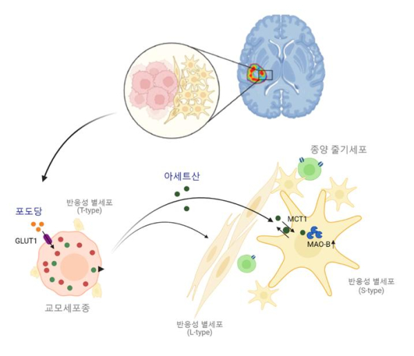 종양 미세환경에서 종양세포 유래 아세트산을 이상 과다 흡수하여 일어나는 반응성 별세포화 기전