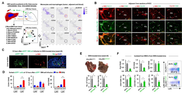 간암 환자의 간 조직을 이용한 단일세포유전체 분석에서 CX3CR1과 ARG1을 발현하는 대식세포 군집을 특정하고 해당 대식세포가 활성화된 간성상세포와 근접하여 상호작용함을 확인함.