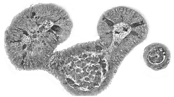 측정된 장 오가노이드의 단면 이미지