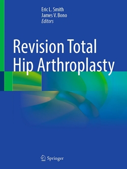 Revision Total Hip Arthroplasty