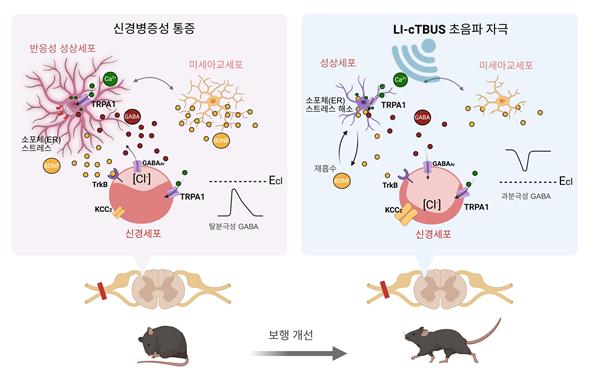 저강도 연속 세타버스트 초음파가 통증을 완화하는 작동 원리